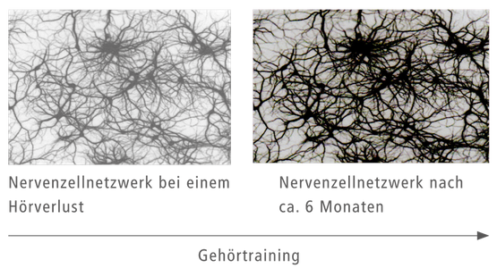 Hören ist Kopfsache