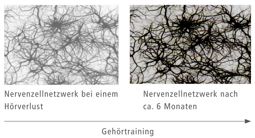 Hören ist Kopfsache